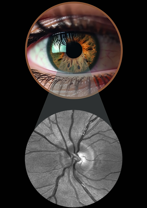 retina concept - from retina to jewelry