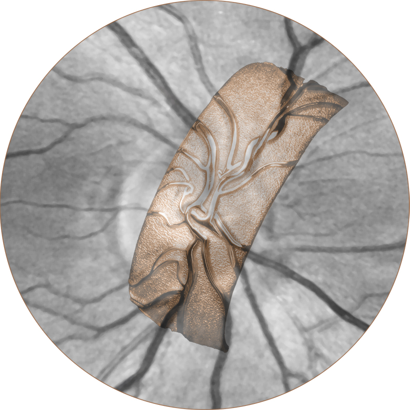 Eure Retina-Signatur als persönliches Muster
